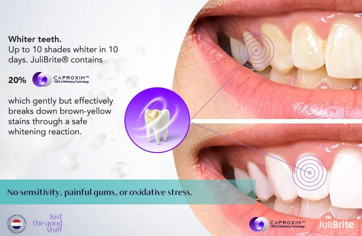 JuliBrite® Whitening Kit Voor Thuis Tanden Bleken