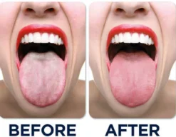 Moist-R® Hydraterende Tongspray | 30 ml