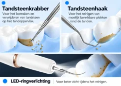 Oral Icon® Elektrische Tandsteen Verwijderaar