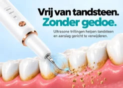 Oral Icon® Elektrische Tandsteen Verwijderaar
