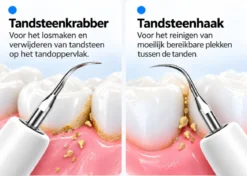 Oral Icon® Elektrische Tandsteen Verwijderaar