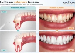 Oral Icon® Pulserende Elektrische Waterflosser