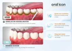 Oral Icon® Pulserende Elektrische Waterflosser