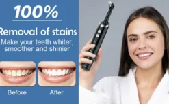 Oral Icon® Tooth Polisher - Tanden polijster