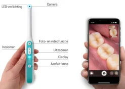 Oravall® Dental Camera met LED - Controleer Mond & Keel Live