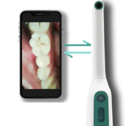Oravall® Dental Camera met LED - Controleer Mond & Keel Live