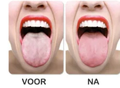 Tongue Clean Voordeelkit
